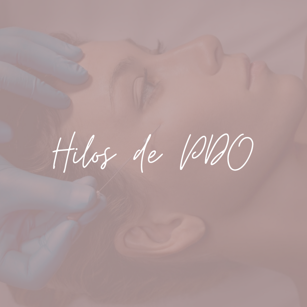 Hilos de PDO (apartado)