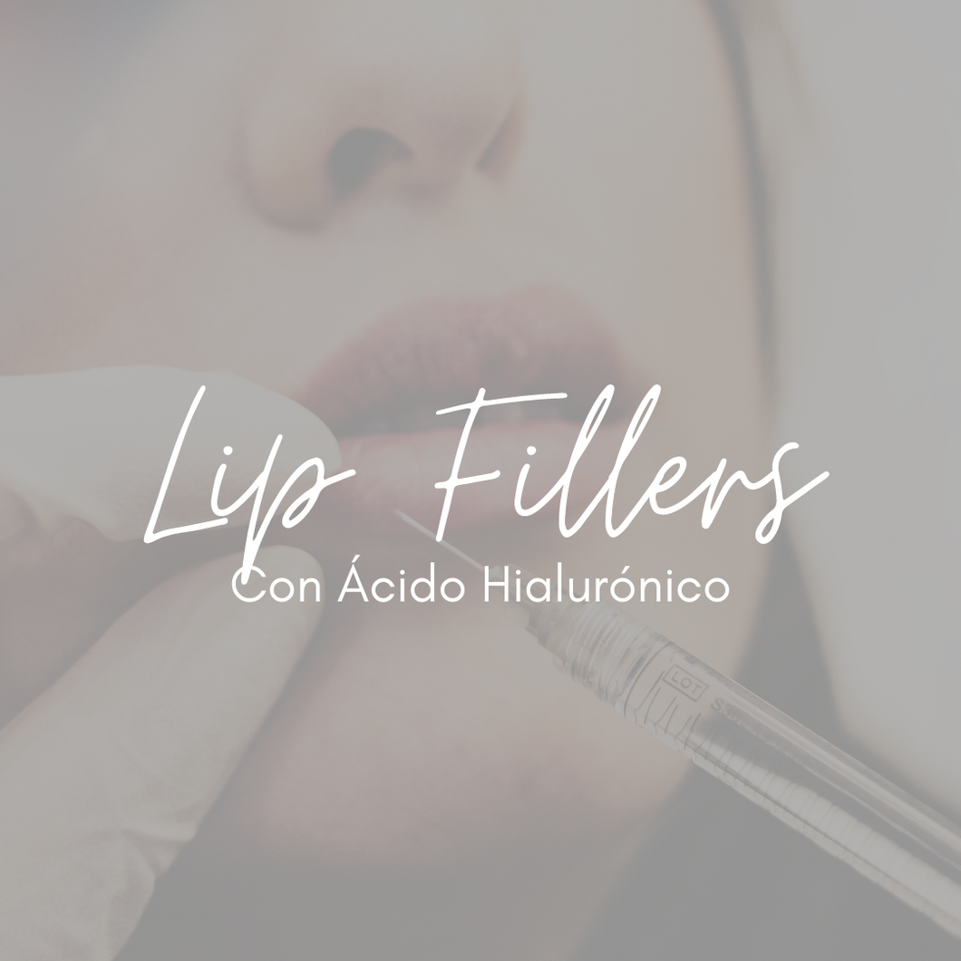 Relleno de Labios con Ácido Hialurónico